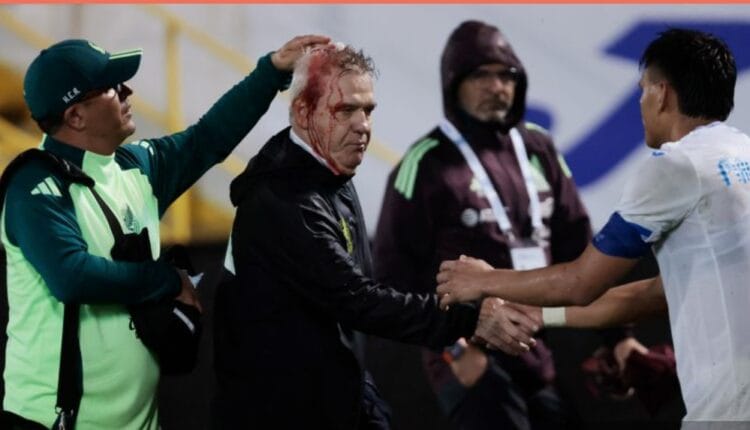 Chaos in CONCACAF: Mexico Coach Struck by Missile